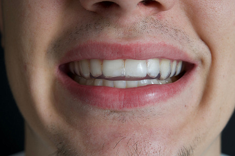 Капа для хоккея, регби и баскетбола